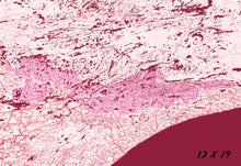 Load image into Gallery viewer, Boundary Waters Map Print