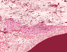 Load image into Gallery viewer, Boundary Waters Map Print